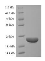 Bovine C-C motif chemokine 20 (CCL20) Recombinant Protein, N-His-SUMO - BioCrest Sci
