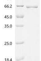 Human T-complex protein 1 subunit beta (CCT2) Recombinant Protein, N-His, aa 2–535, E.coli - BioCrest Sci