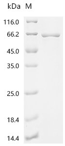 Human T-complex protein 1 subunit beta (CCT2) Recombinant Protein, N-His, aa 2–535, E.coli, Homo sapiens (Human), E.coli, N-terminal 6xHis-tagged, 64.3 kDa, purity >≥ 85% as determined by SDS-PAGE.