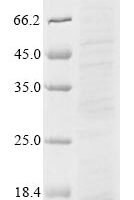Human Bone morphogenetic protein 3 (BMP3) Recombinant Protein, C-Myc - BioCrest Sci