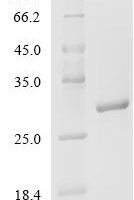 Mouse Helicase-like transcription factor (Hltf), partial Recombinant Protein - BioCrest Sci