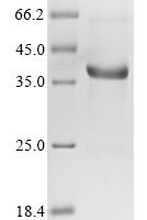 Human Neurofibromin (NF1), partial Recombinant Protein - BioCrest Sci