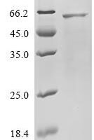 Human Cis-aconitate decarboxylase(ACOD1) Recombinant Protein - BioCrest Sci