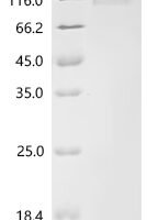 Dog Folate hydrolase 1 (folh1), partial Recombinant Protein - BioCrest Sci