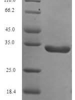 Human Parkinson disease protein 7 (PARK7), partial Recombinant Protein, N-His-SUMO - BioCrest Sci