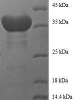 Human Histone H2B type 1-C/E/F/G/I (H2BC4), partial Recombinant Protein - BioCrest Sci