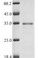 Human Non-receptor tyrosine-protein kinase TYK2 (TYK2), partial Recombinant Protein, N-10His - BioCrest Sci