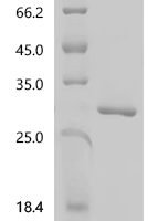 Mouse Cerebellin-4 (Cbln4) Recombinant Protein, C-His, aa 25–198, E.coli - BioCrest Sci