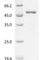 Human Transmembrane protease serine 13 (TMPRSS13), partial Recombinant Protein - BioCrest Sci