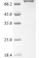 Human parechovirus 2 Genome polyprotein, partial,Biotinylated Recombinant Protein - BioCrest Sci