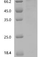 Human Interleukin-3 receptor subunit alpha (IL3RA), partial Recombinant Protein - BioCrest Sci
