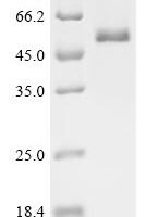 Human DNA replication ATP-dependent helicase/nuclease DNA2 (DNA2),  partial Recombinant Protein - BioCrest Sci