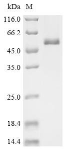 Human DNA replication ATP-dependent helicase/nuclease DNA2 (DNA2), partial Recombinant Protein, Homo sapiens (Human), Baculovirus, C-terminal 6xHis-tagged, 53.2 kDa, purity >≥ 95% as determined by SDS-PAGE.