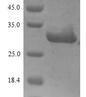 Human Heat shock protein HSP 90-alpha (HSP90AA1), partial Recombinant Protein, N-His, aa 9–232 - BioCrest Sci
