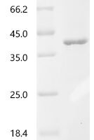 Influenza B virus Nucleoprotein (NP), partial Recombinant Protein, C-His, aa 1–245, E.coli - BioCrest Sci