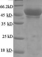 Mouse Hydroxyacyl-coenzyme A dehydrogenase, mitochondrial (Hadh) Recombinant Protein - BioCrest Sci