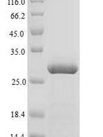 Bovine Agouti-signaling protein (ASIP) Recombinant Protein - BioCrest Sci