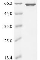 Human Bifunctional arginine demethylase and lysyl-hydroxylase JMJD6 (JMJD6) Recombinant Protein - BioCrest Sci