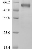 Human B- and T-lymphocyte attenuator (BTLA), partial,Biotinylated Recombinant Protein - BioCrest Sci