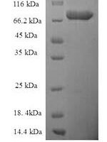 Human Bifunctional Epoxide hydrolase 2 (EPHX2) Recombinant Protein - BioCrest Sci