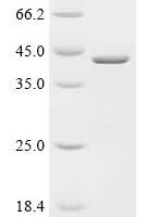 Human G antigen 7 (GAGE7) Recombinant Protein - BioCrest Sci