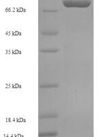 Human Crossover junction endonuclease EME1 (EME1) Recombinant Protein - BioCrest Sci