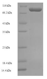 Human Crossover junction endonuclease EME1 (EME1) Recombinant Protein, Homo sapiens (Human), E.coli, N-terminal 6xHis-SUMO-tagged, 80.8 kDa, purity >≥ 90% as determined by SDS-PAGE.