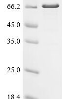 Human papillomavirus type 18 Minor capsid protein L2 (L2) Recombinant Protein, C-His - BioCrest Sci