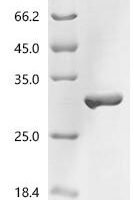 Tomato bushy stunt virus RNA silencing suppressor p19 Recombinant Protein - BioCrest Sci