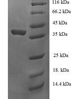 Human Upstream stimulatory factor 1 (USF1), partial Recombinant Protein - BioCrest Sci