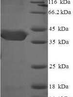 Human CUE domain-containing protein 2 (CUEDC2), partial Recombinant Protein - BioCrest Sci