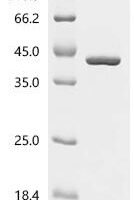 Human HLA class I histocompatibility antigen, C alpha chain (HLA-C), partial Recombinant Protein - BioCrest Sci