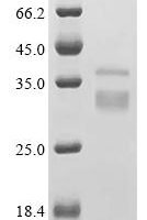 Saccharomyces cerevisiae Chitin deacetylase 1 (CDA1) Recombinant Protein - BioCrest Sci