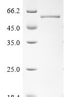 Human Melanoma-associated antigen C2 (MAGEC2) Recombinant Protein - BioCrest Sci