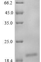 Mouse Nogo-B receptor (Nus1), partial Recombinant Protein, C-His - BioCrest Sci