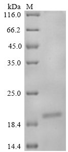 Mouse Nogo-B receptor (Nus1), partial Recombinant Protein, C-His, Mus musculus (Mouse), Yeast, C-terminal 6xHis-tagged, 19.2 kDa, purity >≥ 90% as determined by SDS-PAGE.