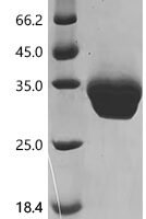 Human Immunoglobulin superfamily member 11 (IGF1R), partial Recombinant Protein - BioCrest Sci