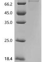 Human GTP-binding protein GEM (GEM) Recombinant Protein, C-10His-HSA - BioCrest Sci