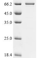 Mesocricetus auratus T-cell surface glycoprotein CD4 (Cd4), partial Recombinant Protein - BioCrest Sci