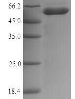 Escherichia coli Murein hydrolase activator NlpD (nlpD) Recombinant Protein - BioCrest Sci
