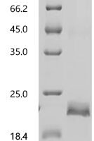 Rat Vascular endothelial growth factor D (Vegfd) Recombinant Protein, C-His - BioCrest Sci