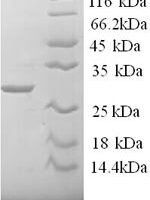 Mouse Tryptase (Tpsab1), partial Recombinant Protein - BioCrest Sci