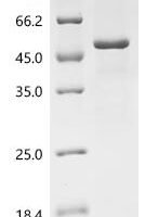 Mouse Actin-binding LIM protein 1 (Ablim1), partial Recombinant Protein - BioCrest Sci