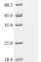 Human Bromodomain-containing protein 4 (BRD4), partial Recombinant Protein, N-His - BioCrest Sci