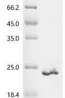 Rhesus cytomegalovirus Envelope glycoprotein B (gB), partial Recombinant Protein - BioCrest Sci