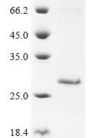 Human Ropporin-1A (ROPN1) Recombinant Protein - BioCrest Sci