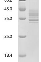 Human Tumor necrosis factor receptor superfamily member 13C (TNFRSF13C), partial Recombinant Protein, C-hFc1 - BioCrest Sci
