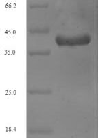 Human Vesicle-associated membrane protein 2 (VAMP2) Recombinant Protein - BioCrest Sci