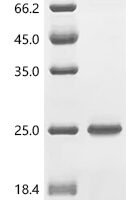 Mycobacterium tuberculosis Meromycolate extension acyl carrier protein (acpM) Recombinant Protein, N-His - BioCrest Sci