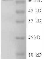 Human Intercellular adhesion molecule 1 (ICAM1), partial Recombinant Protein - BioCrest Sci
